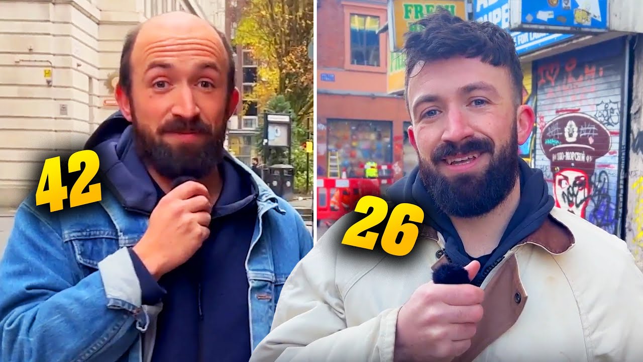 Public Guess My Age Before & After Hair Replacement