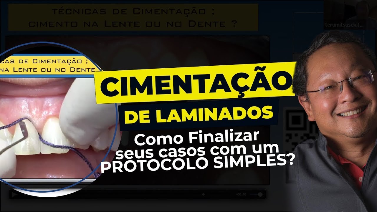 Cimentação de Laminados: Como Finalizar seus casos com um protocolo simples.