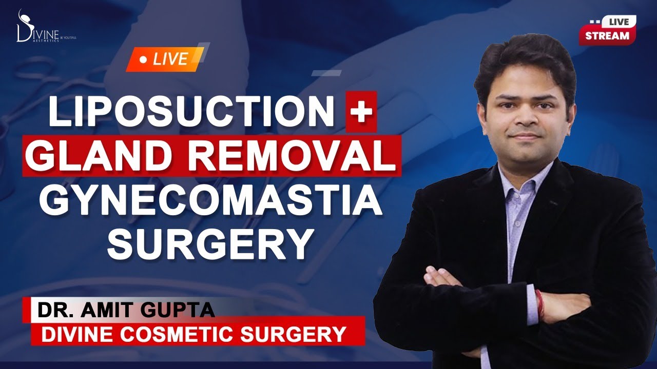Liposuction + Gland Removal Gynecomastia Surgery - Dr Amit Gupta