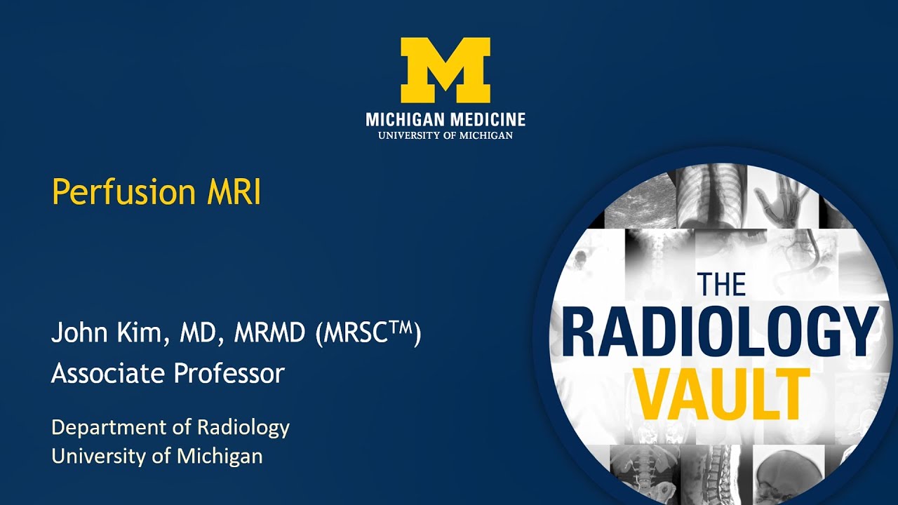 MRI Perfusion-Weighted Imaging of Brain