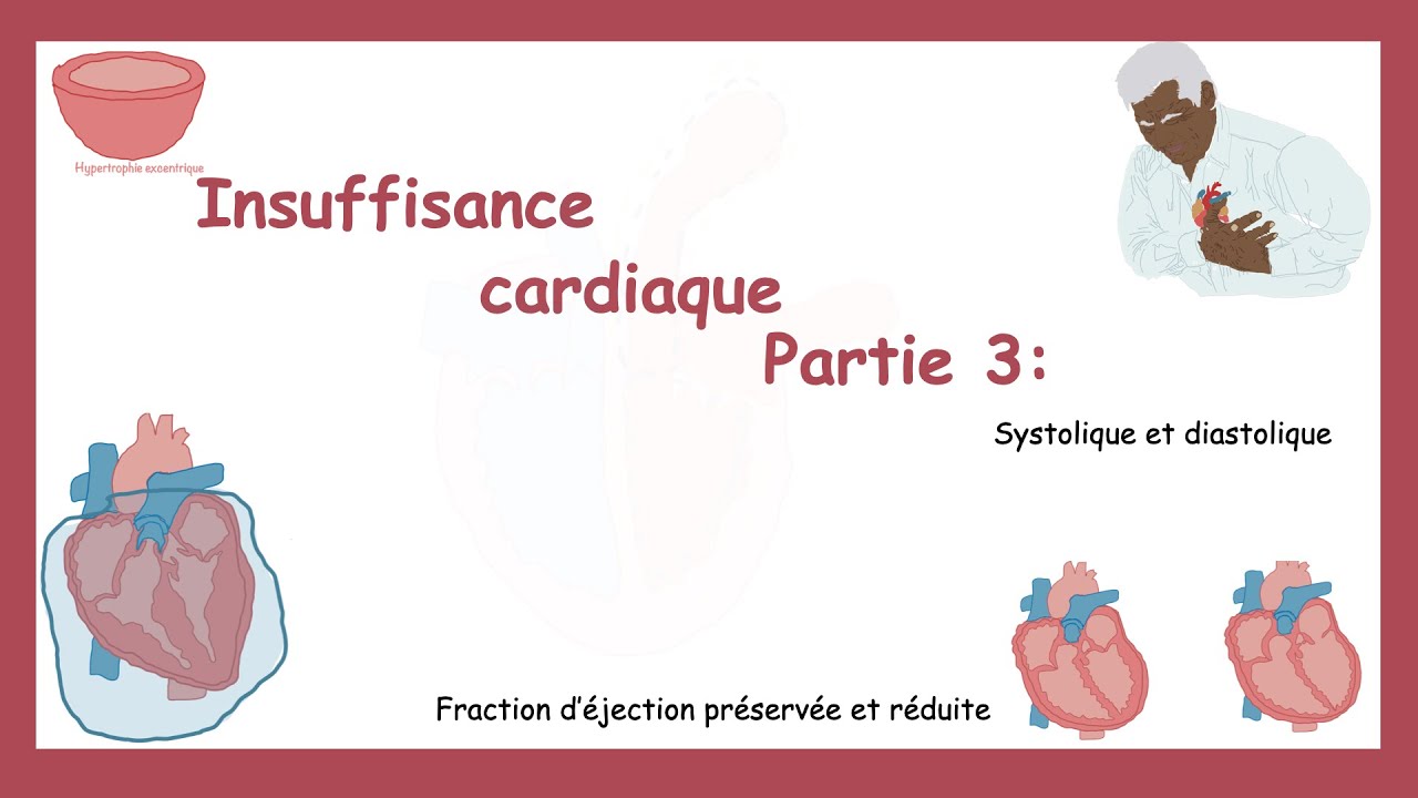 Insuffisance Cardiaque Partie 3: Insuffisance Systolique Et Diastolique.