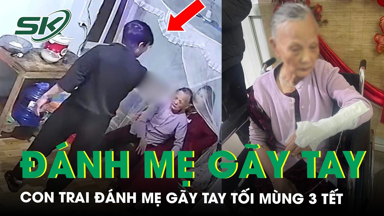 Công an vào cuộc vụ con trai hành hung mẹ gãy tay tối mùng 3 Tết vì không đưa tiền mừng tuổi | SKĐS