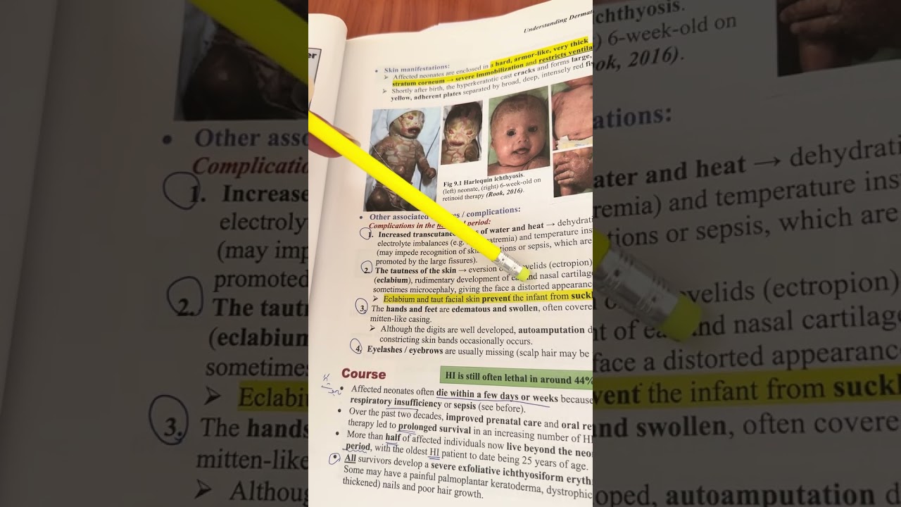 Day 8 Geno| 🧬Harlequin Ichthyosis 🃏