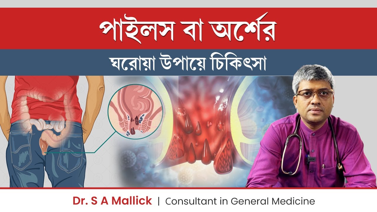 পাইলস বা অর্শ থেকে মুক্তির ১০ টি ঘরোয়া উপায় | Home remedies for Piles | 10 Tips To Get Rid Of Piles