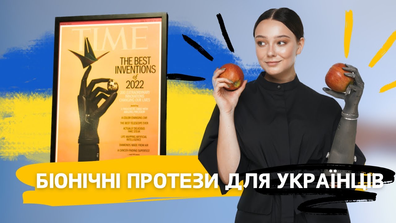 Український біонічний протез руки - одна з найкращих розробок людства