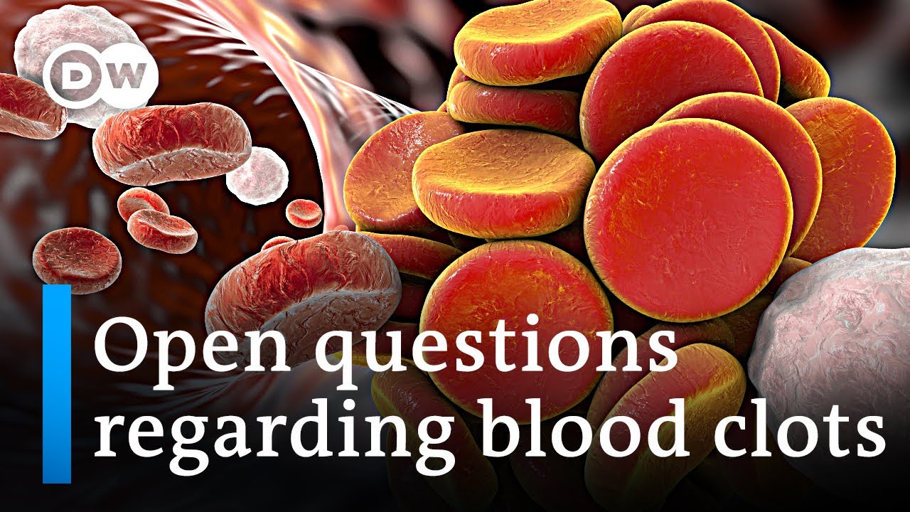 WHO & AstraZeneca say no causal link between vaccine and blood clots | Coronavirus latest