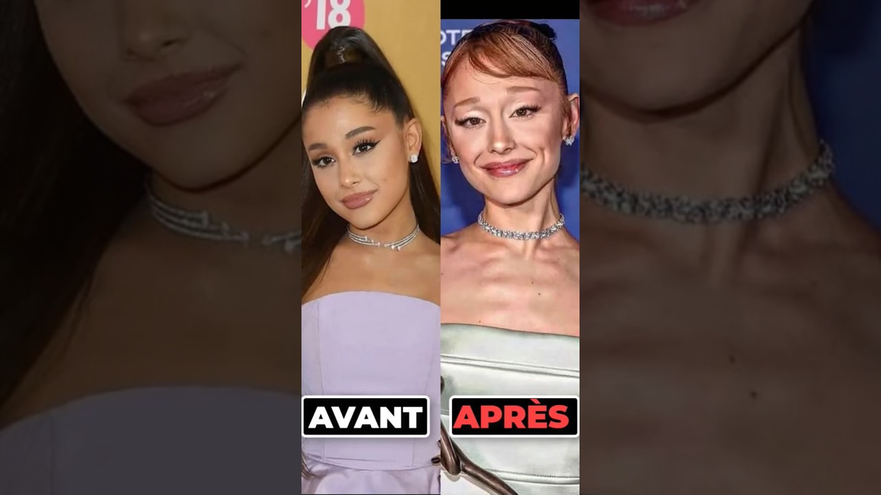 7 C&eacute;l&eacute;brit&eacute;s qui sont mortes du SIDA