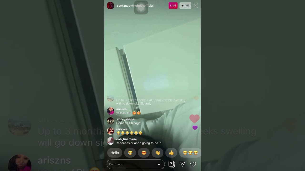 Santana live after surgery 11/14/19