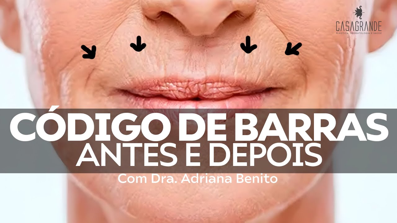RESOLVENDO O CÓDIGO DE BARRAS - ANTES E DEPOIS