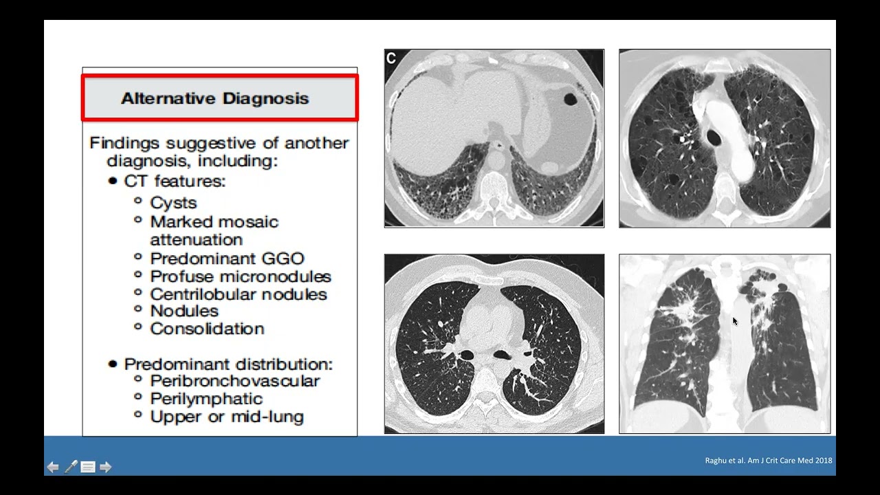 Breast Site Group Presentation: Respirology - April 21, 2022 [#Repost 2025]