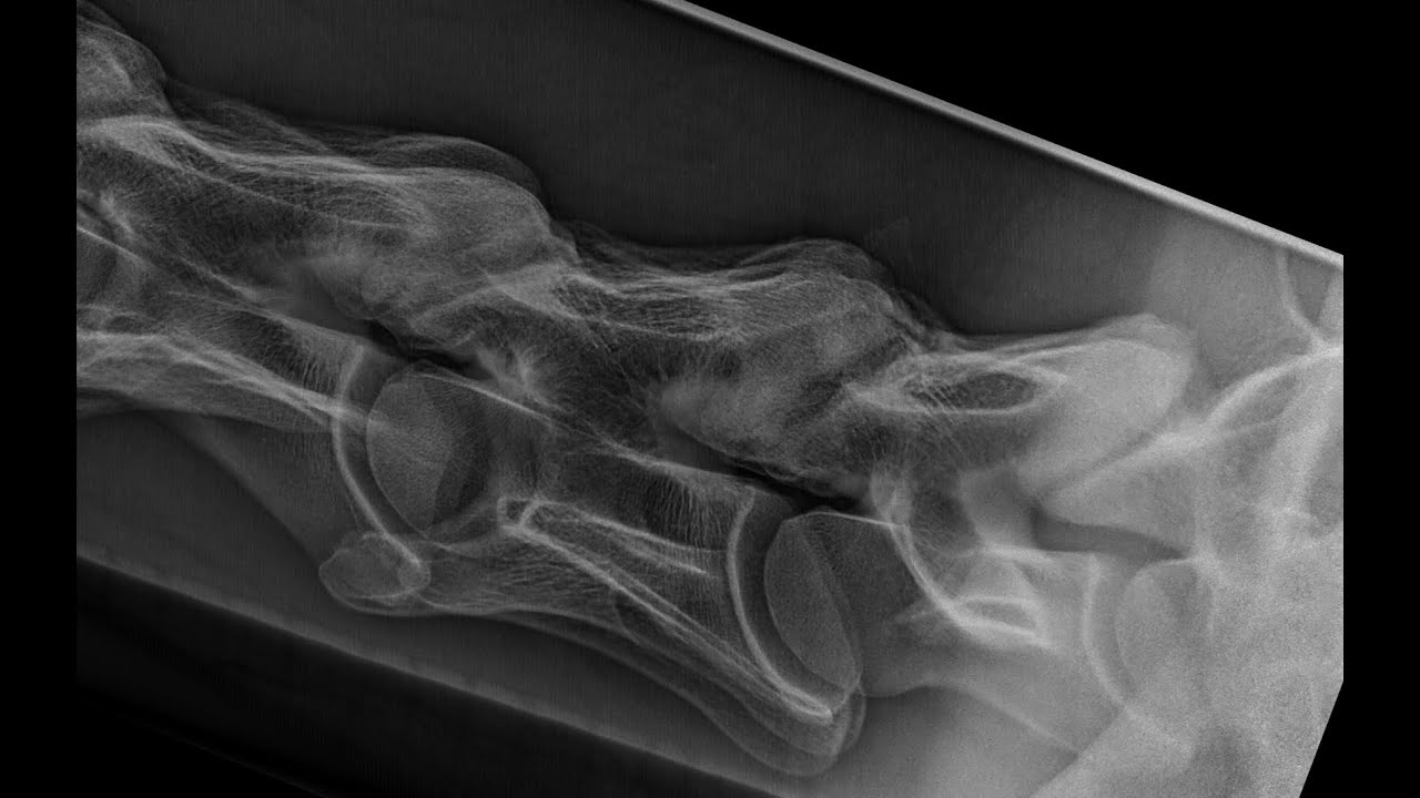 Vlog SMDC Röntgenopnamen hals paard / Equine cervical radiographs - Erik Bergman DVM