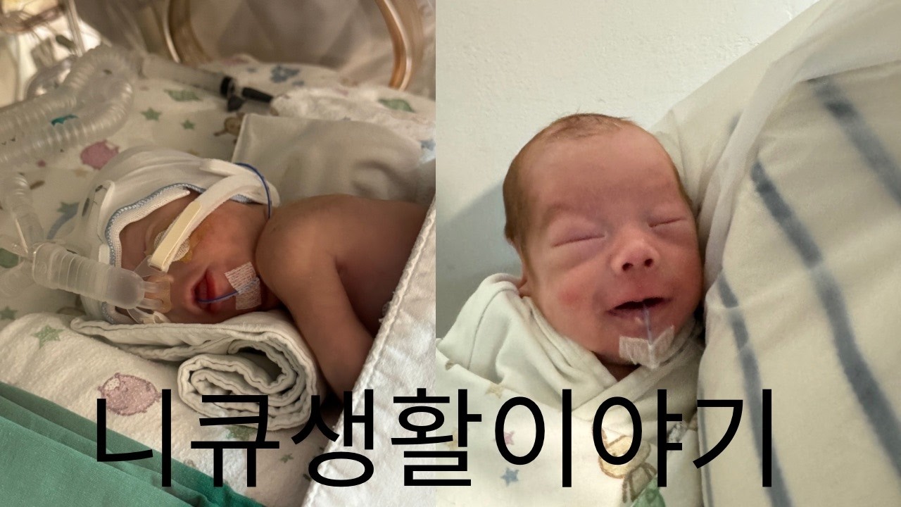31주에 태어나 36주까지 한달간 니큐생활이야기