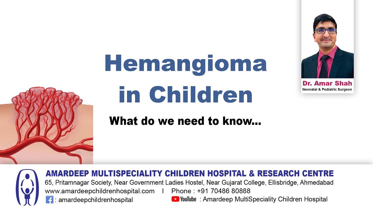 Hemangioma in Children - English