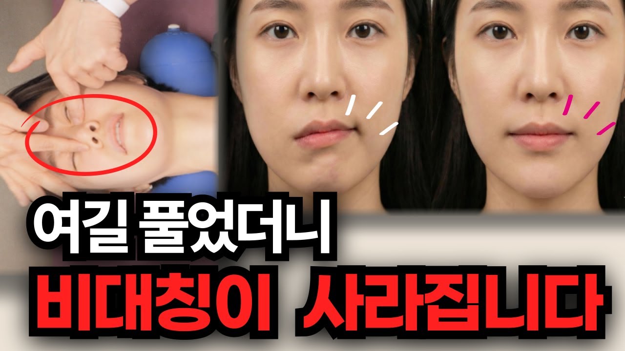 평생 콤플렉스였던 썩소? '이곳' 누르자마자 입술 선이 맞춰집니다 | 안면비대칭 | 턱관절 교정| 입술비대칭