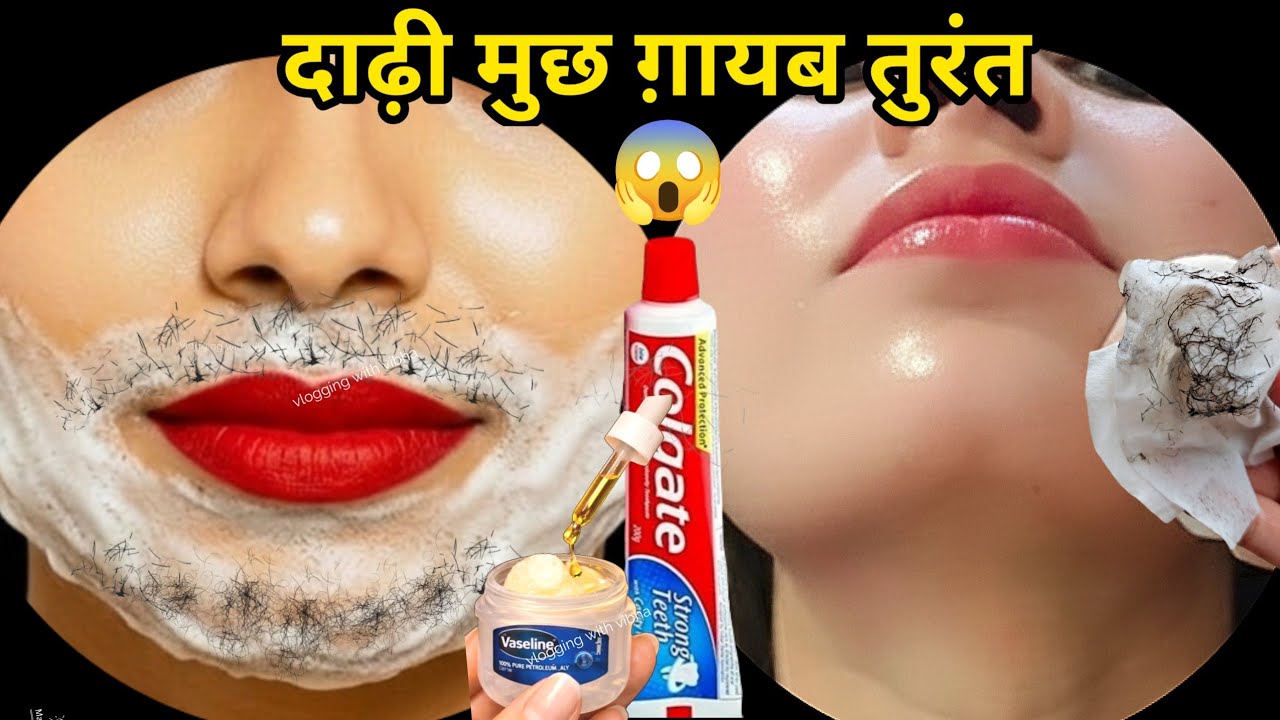 डॉक्टर ने बताया Vaseline से बिना दर्द चेहरे के बाल निकालने का आसान तरीका😱|| Facial Hair Removal
