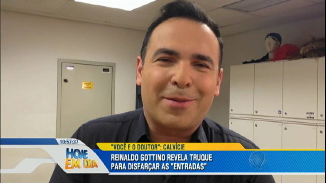 Você e o Doutor explica tudo sobre a calvície masculina