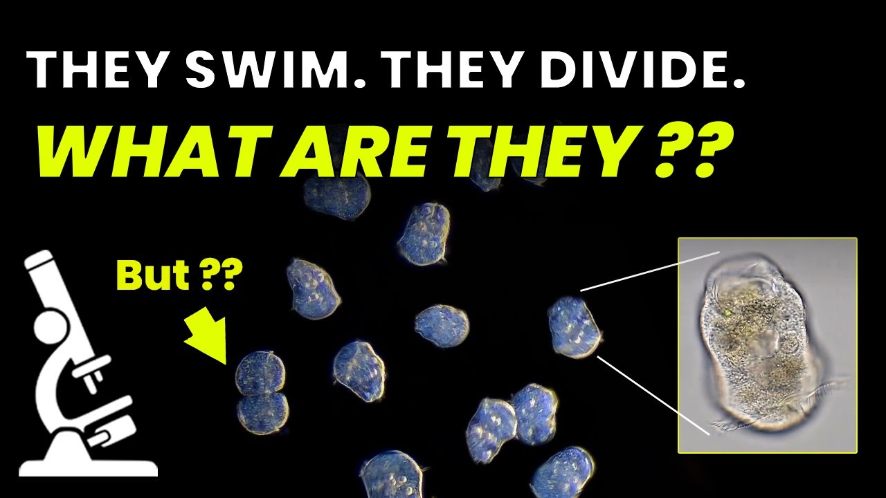 How I ID’d These Ciliates – A Micro Mystery