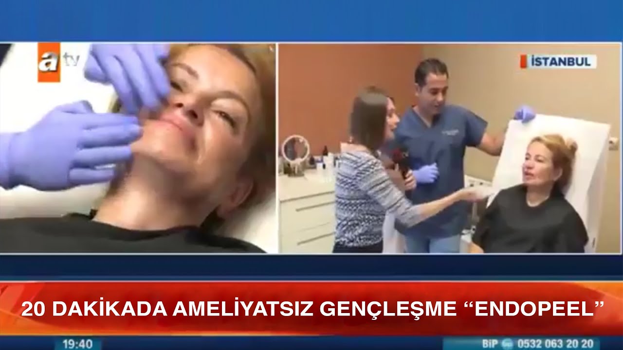 ATV Haber Op.Dr. Burak Türkyılmaz - Endopeel