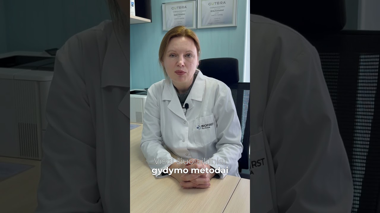 Žvynelinė