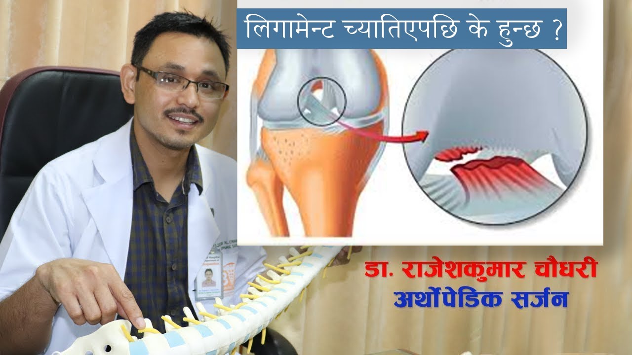 लिगामेन्ट च्यातिएपछि के हुन्छ ? यस्ता छन् डाक्टरको उपाय र सल्लाह...