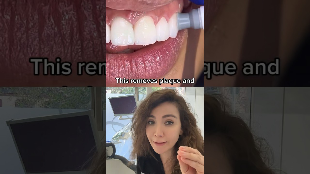 What Is Dental Polishing?!