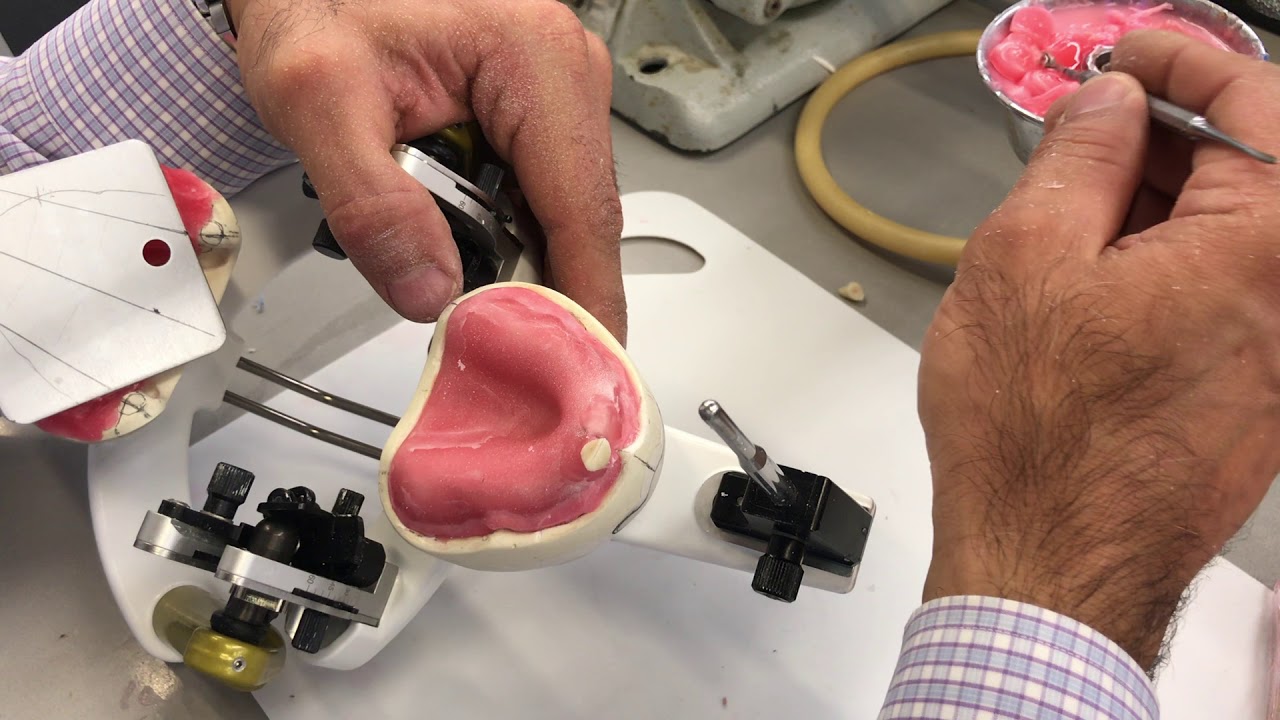 Complete Maxillary and Mandibular Tooth Arrangement #2