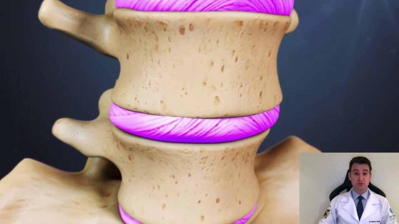 Anatomia da Coluna Lombar