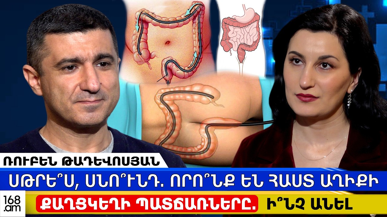 Սթրե՞ս, սնո՞ւնդ. որո՞նք են հաստ աղիքի քաղցկեղի պատճառները. ի՞նչ անել