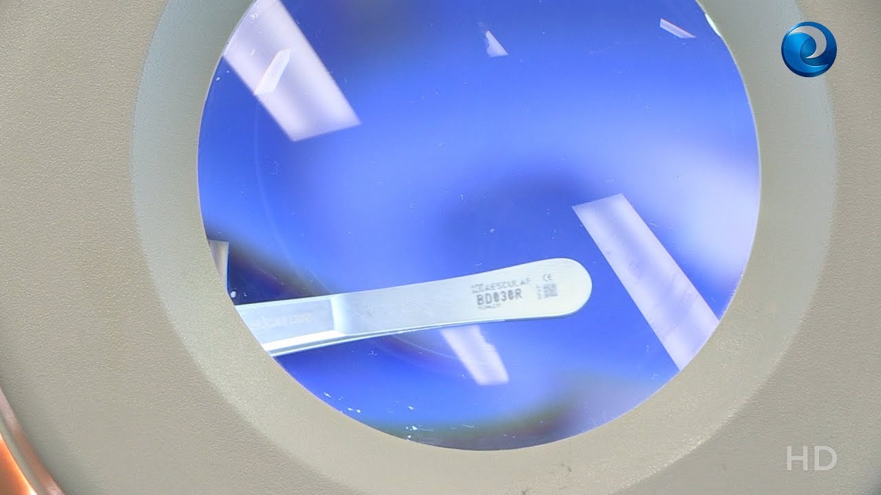 La “matrícula microscópica” que sigue la pista de los instrumentos quirúrgicos en el HUCA