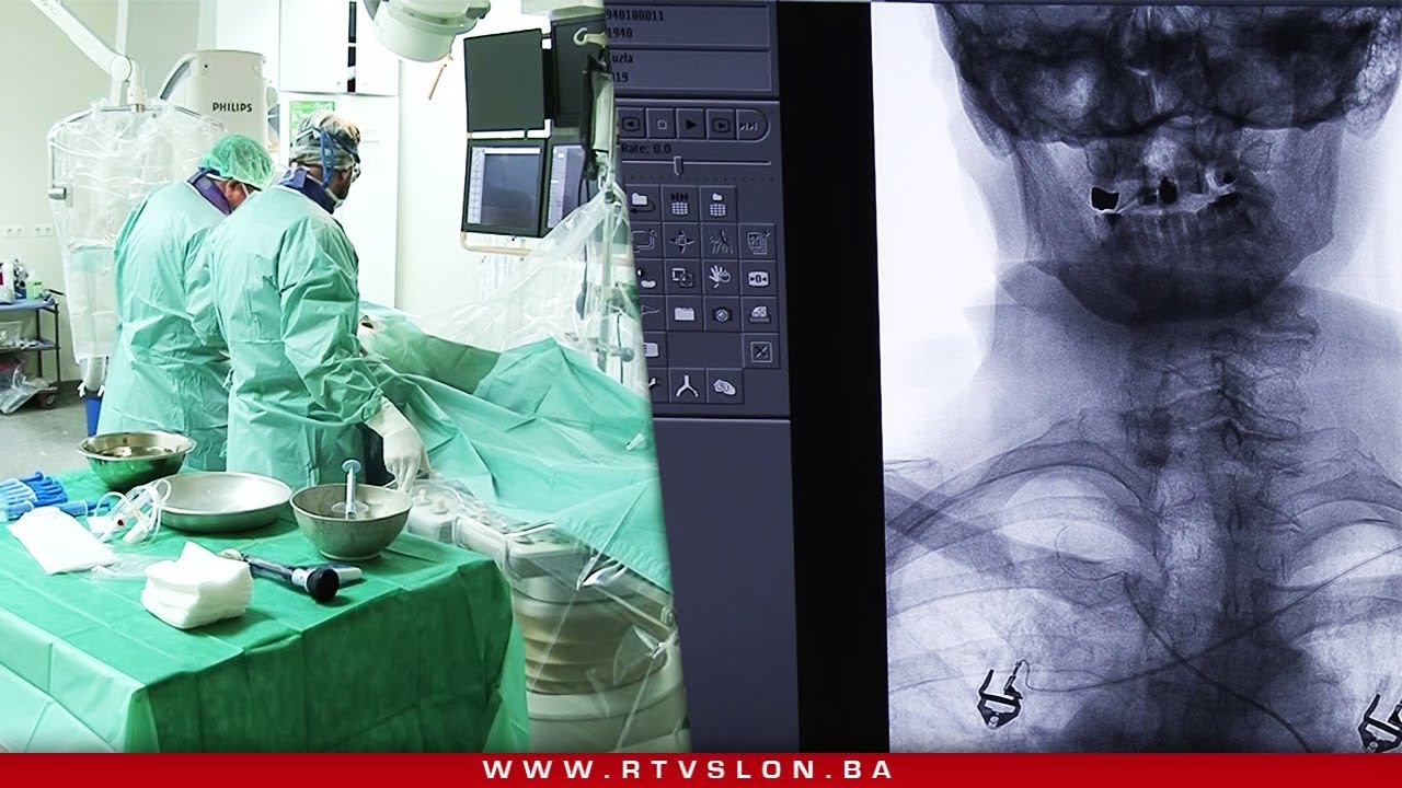 Savremene metode iz endovaskularne neurohirurgije jedino u UKC-u Tuzla – 27.07.2019.