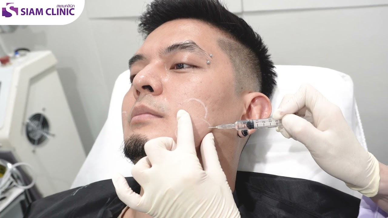 จัดหนัก จัดเต็ม รีวิว Botox เเละ Meso Fat ลงจริง! เรียวจริง! - สยามคลินิก Siam Clinic คลินิกความงาม
