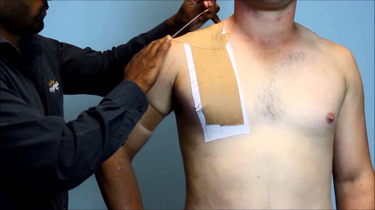 How to tape a shoulder for sport by my Physio SA Physiotherapist Adelaide
