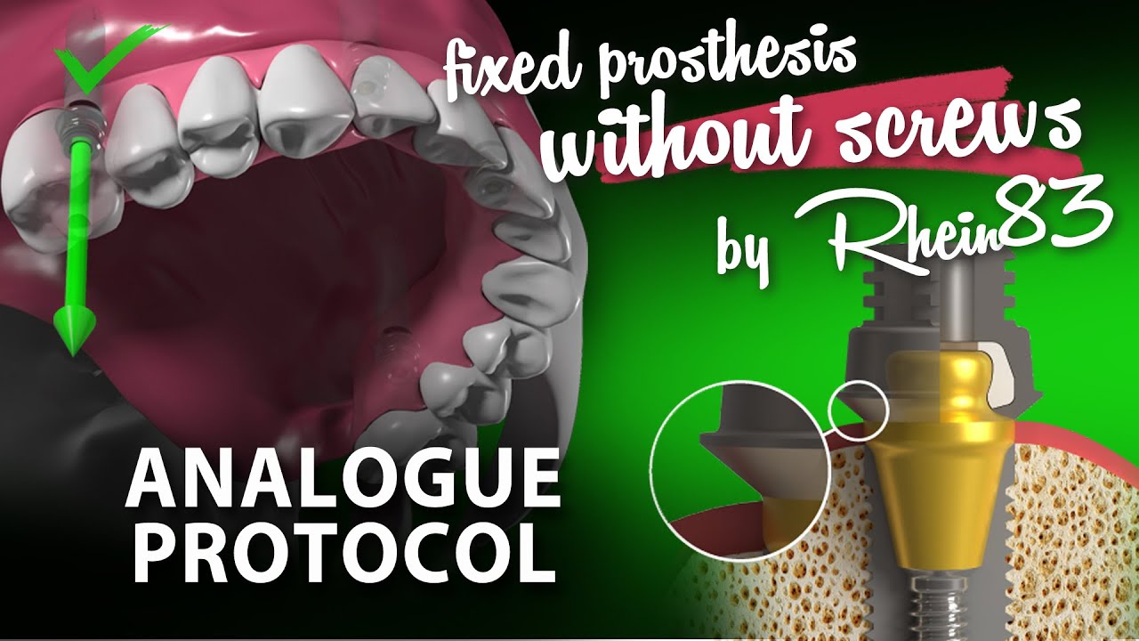 EASY FIX Analogue protocol