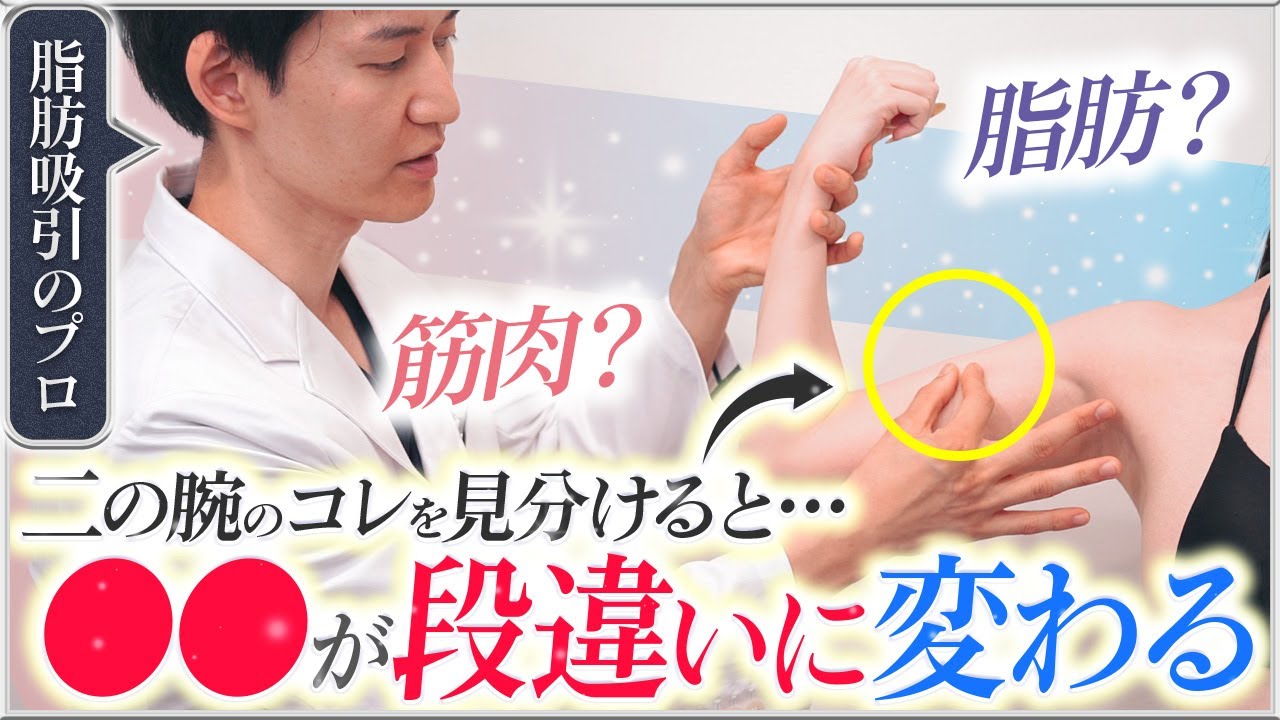 【簡単解説】二の腕脂肪吸引で後悔しないためのポイントとは？脂肪と筋肉の見分け方・セルフチェック方法・部分痩せ効果・腫れや痛みなどのダウンタイム対策まで美容外科医が解説します！