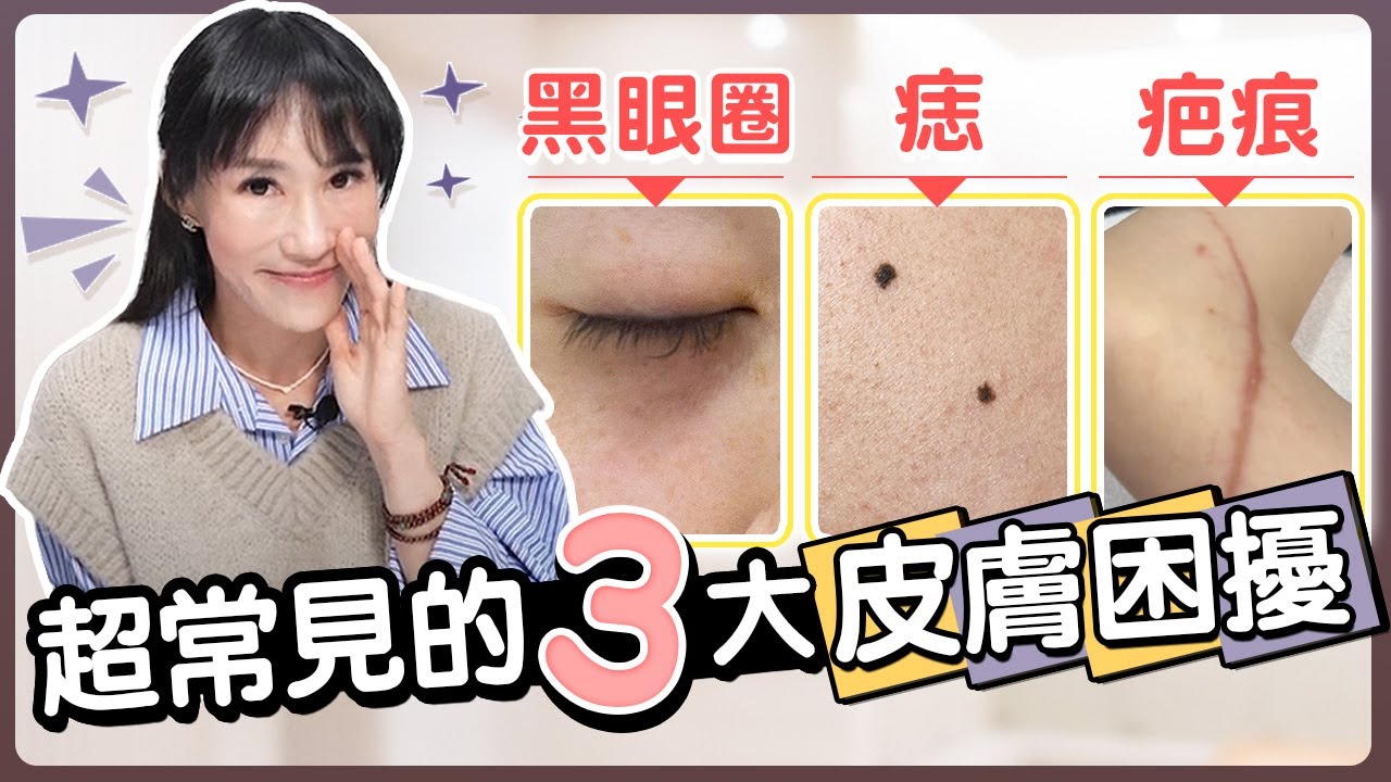 皮秒能有效解決所有困擾嗎？毛孔角化、黑眼圈、疤痕困擾？