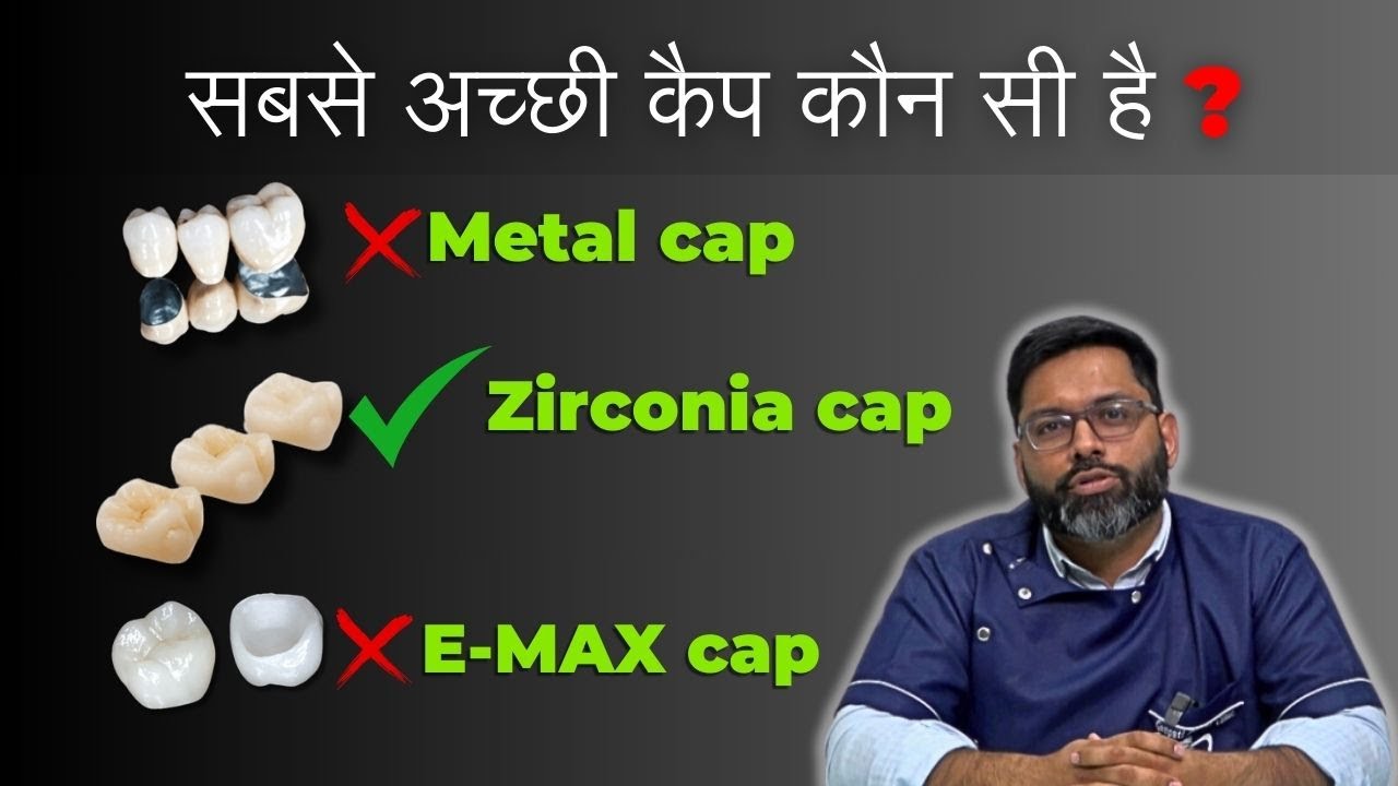 सबसे अच्छी डेंटल कैप कौन सी है? | Metal, Zirconia या E-max कैप | Which is the best dental cap?