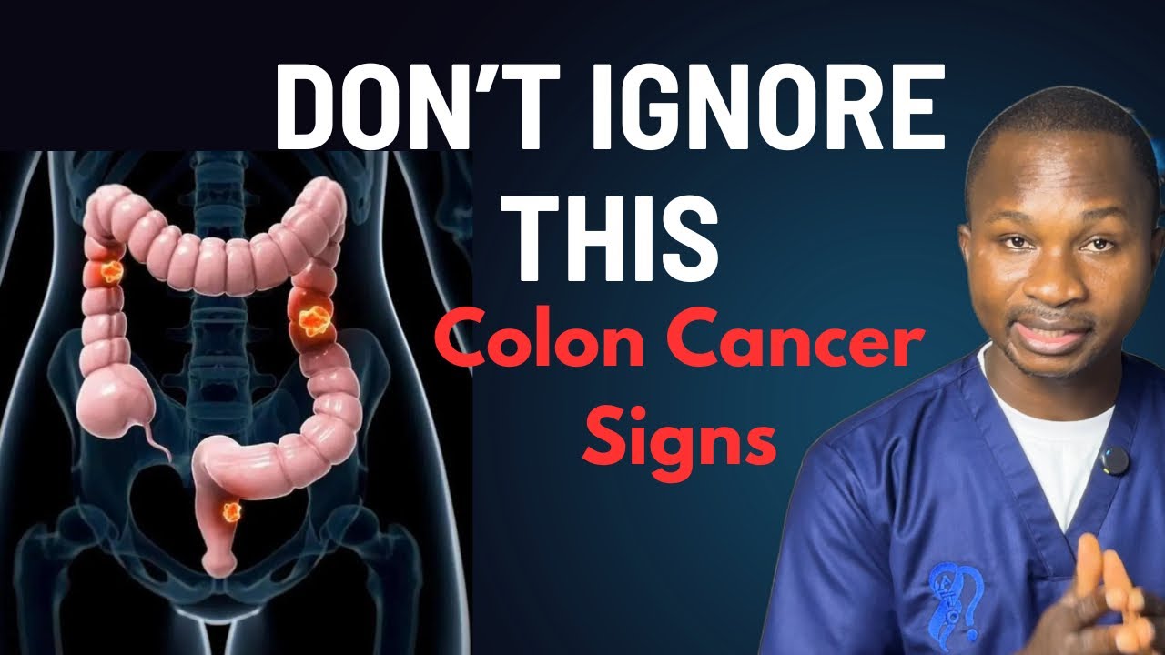5 Warning Signs of Colon Cancer You Should NEVER Ignore