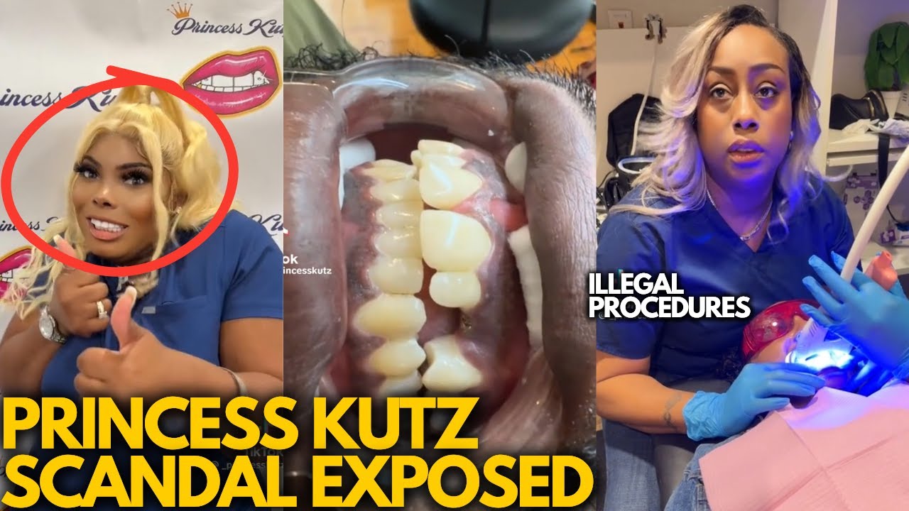 VENEER TECH FACING PRISON TIME?