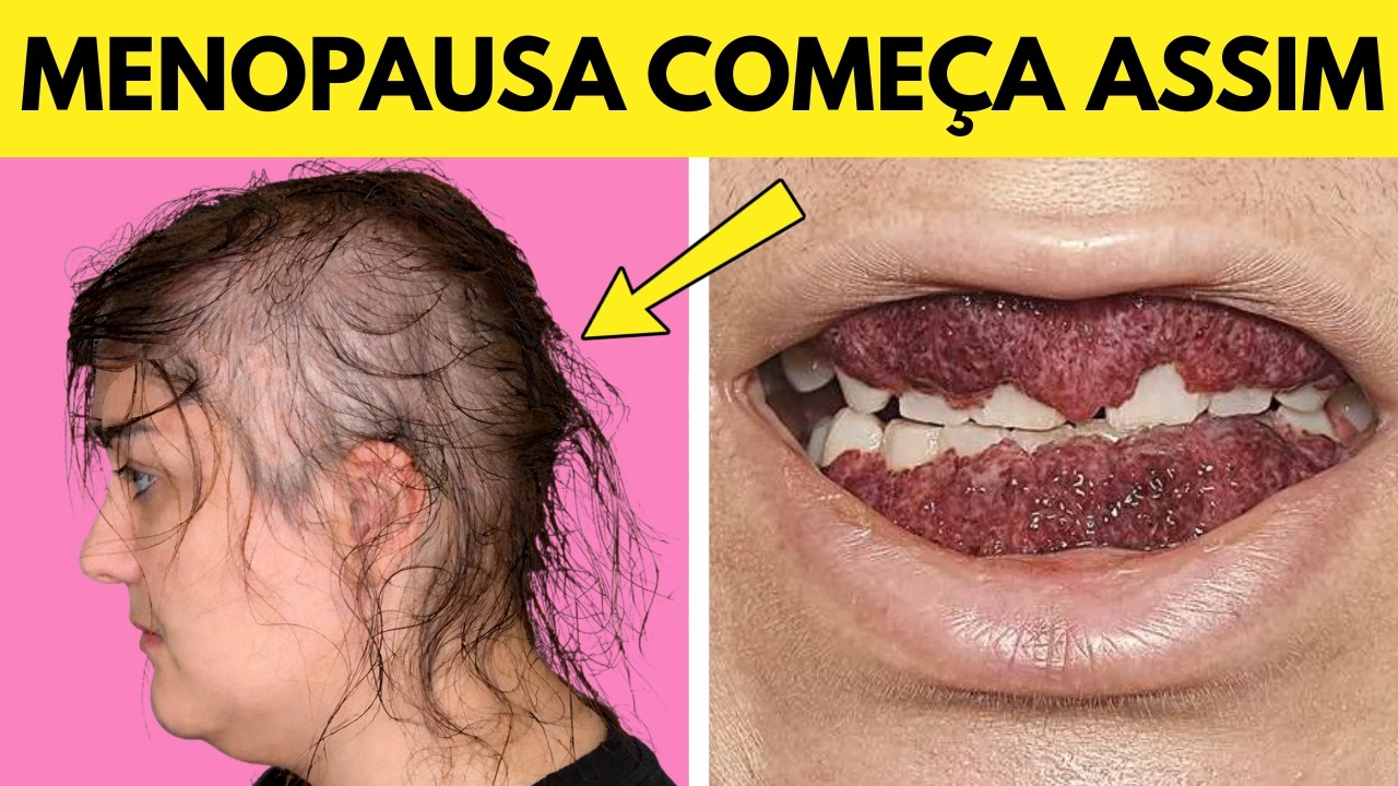 Isso acontece na MENOPAUSA e os GINECOLOGISTAS escondem