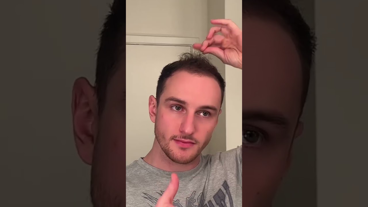 Coconut oil is a miracle #hair #hairgrowth #hairtransformation #coconutoil #rosemaryoil