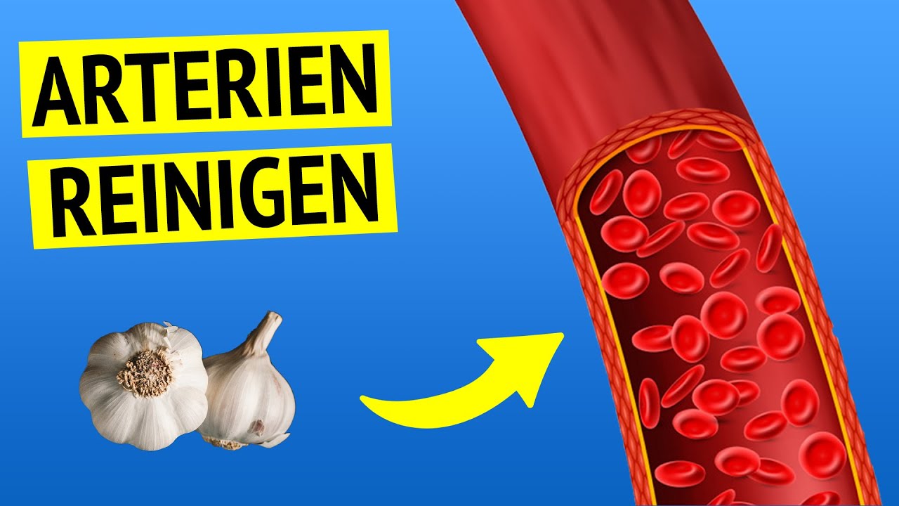 Dieses Hausmittel reinigt deine Arterien von innen und senkt den Blutdruck