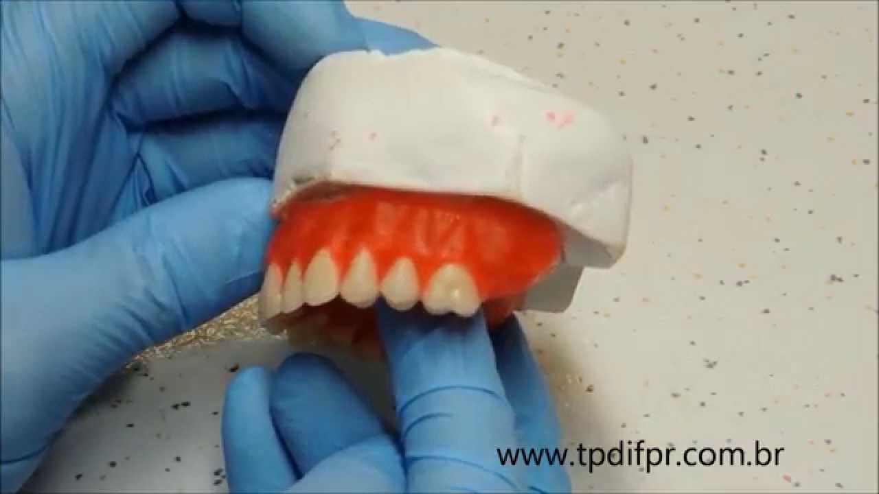 Ceroplastia de Prótese Total