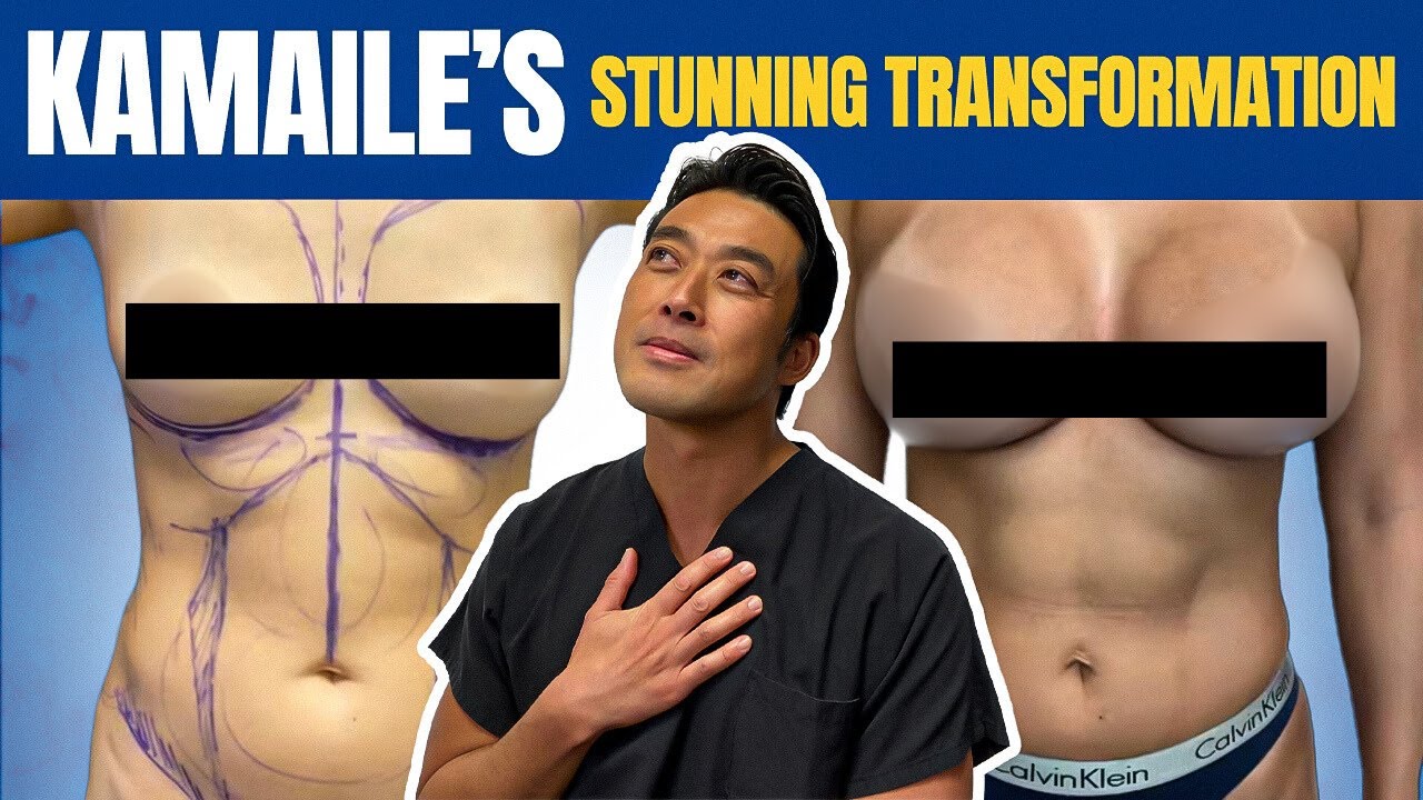 Kamaile shares her Mommy Makeover Testimonial with Dr. Shim Ching