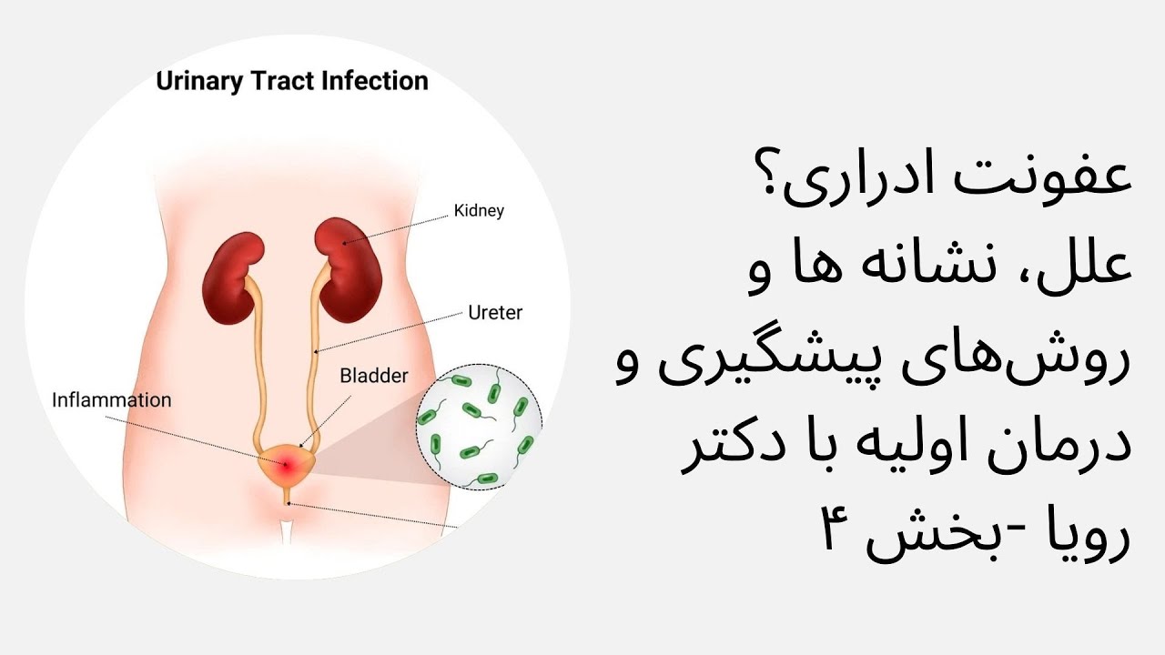 عفونت ادراری؟علل، نشانه ها و روش‌های پیشگیری و درمان اولیه با‌ دکتر رویا -بخش ۴