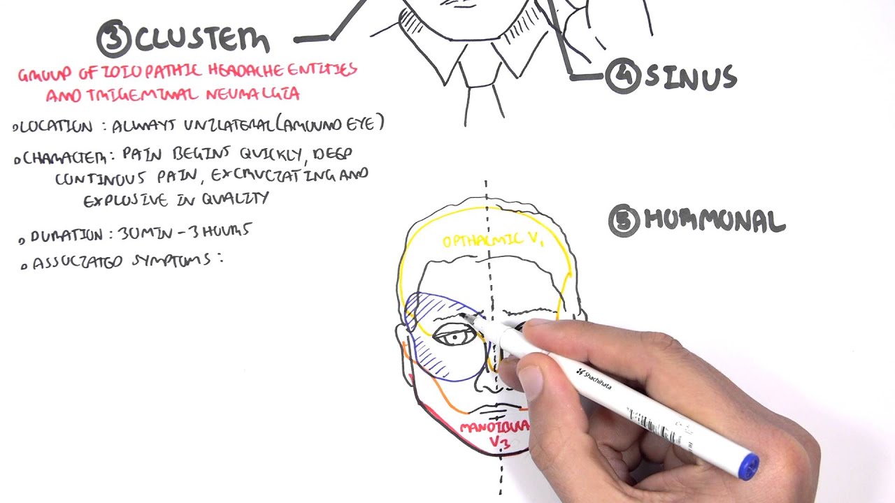 Headache - Overview (types, signs and symptoms, treatment)