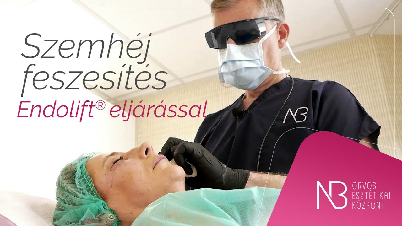 Szemhéj feszesítés Endolift® eljárással - NewBeauty