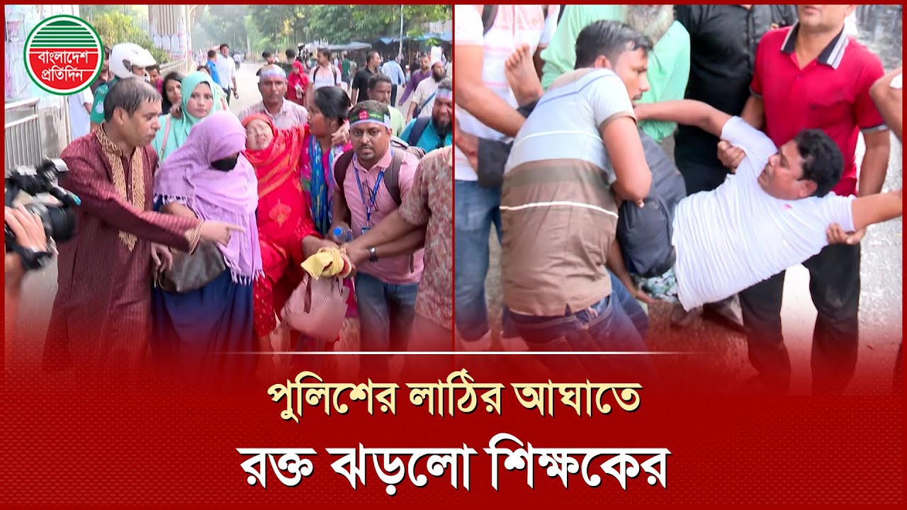 পুলিশের লা'ঠির আ'ঘাতে আ'হত শিক্ষক | Teacher Protest | Police Action | Shahbagh | Bangladesh Pratidin
