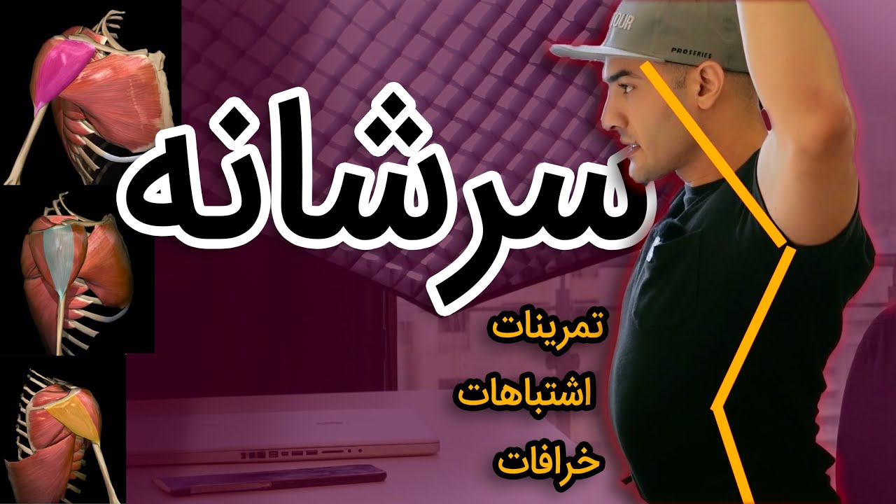 رایج‌ترین اشتباه در تمرین سرشونه و حرکات جایگزین آن (355 ) common shoulder training mistake
