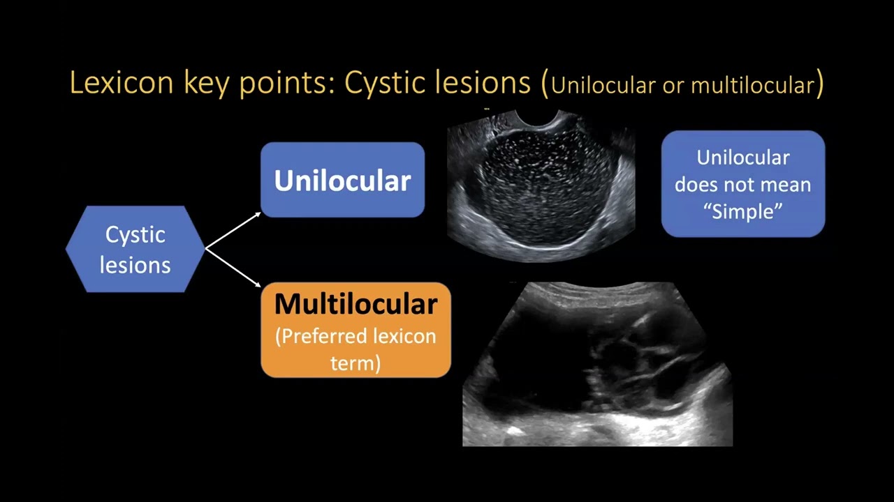 Mastering the Essentials: Female Genitourinary and Benign Gynecologic Imaging - Sample