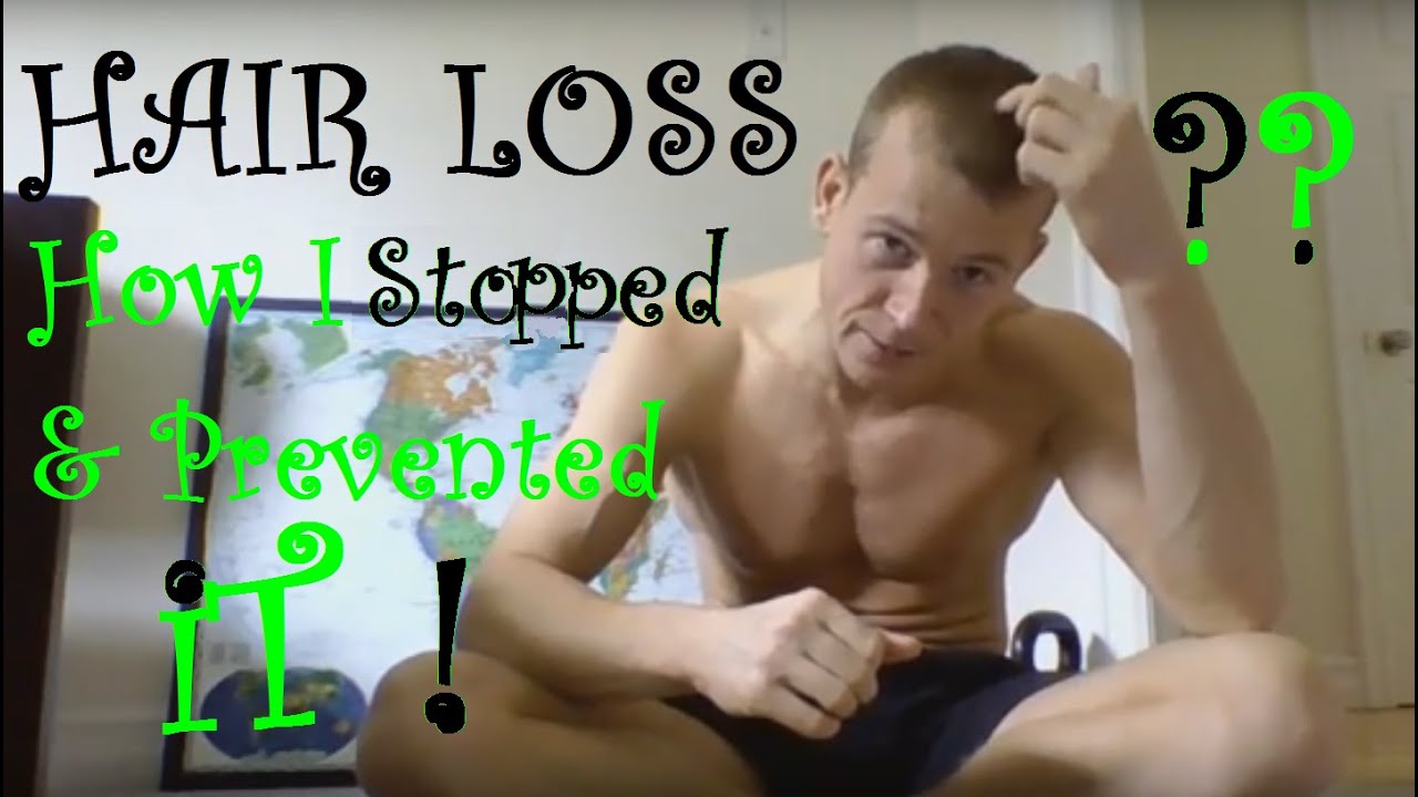 HAIR LOSS: How I Stopped It Naturally - for Men & Women